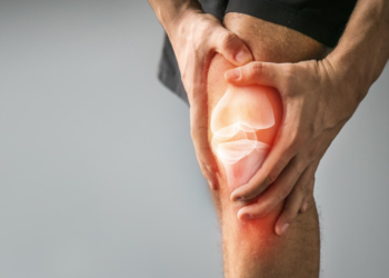knee osteoarthritis