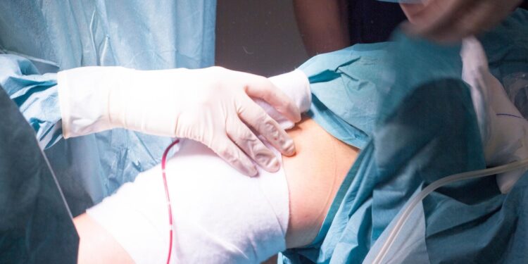 knee replacement